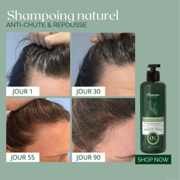 Natural Anti-Hair Loss & Regrowth Duo – 300ml Shampoo & 100ml Lotion – 90-Day Treatment